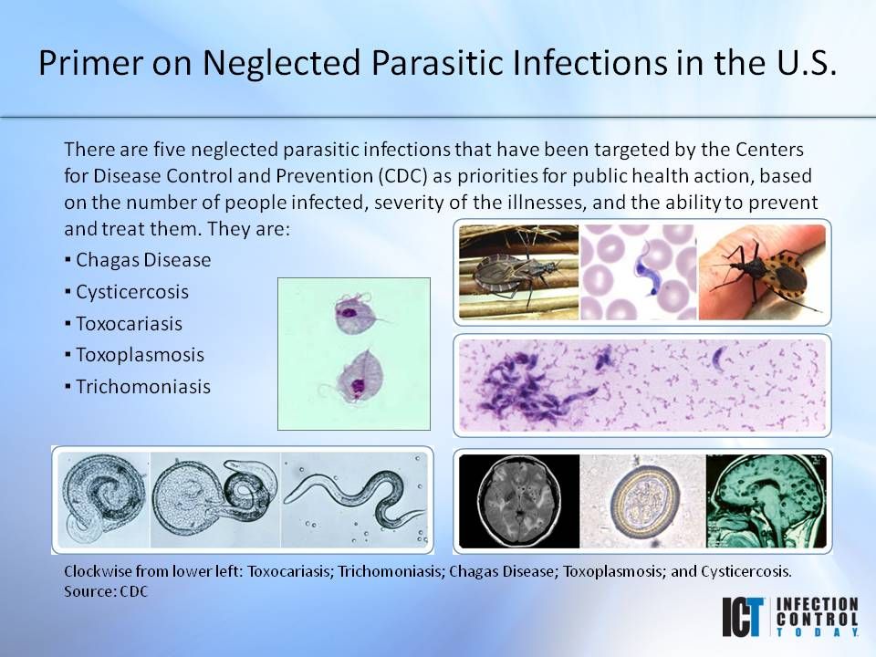 Slide Show A Primer On Neglected Parasitic Infections Infection Control Today 