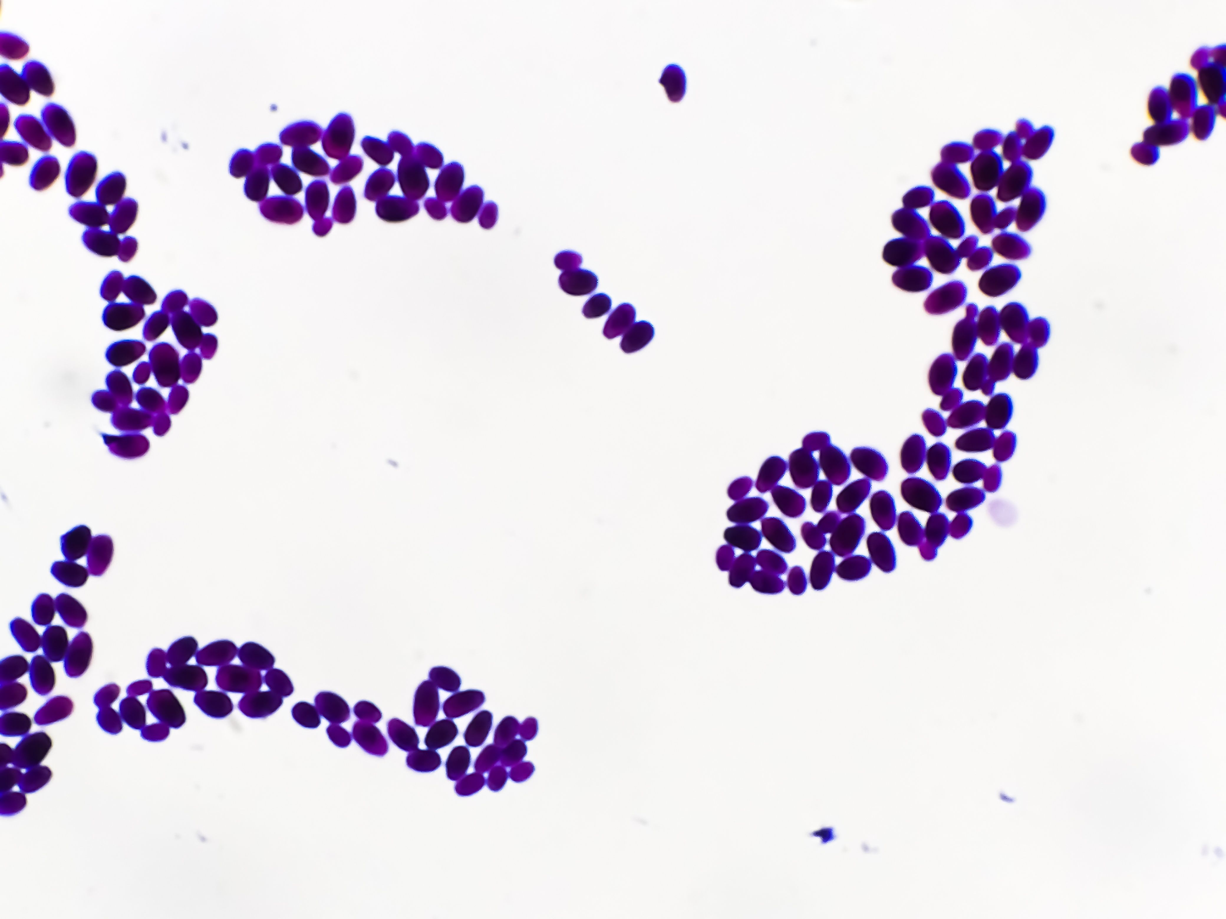 Culture colonies Gram-stained Microscopic 100x show Candida spp, fungi, and emerging multidrug fungus. Candida albicans, C auris, and other yeast fungi. Close-up micrograph. (Adobe Stock 472332177 by Arif Biswas)