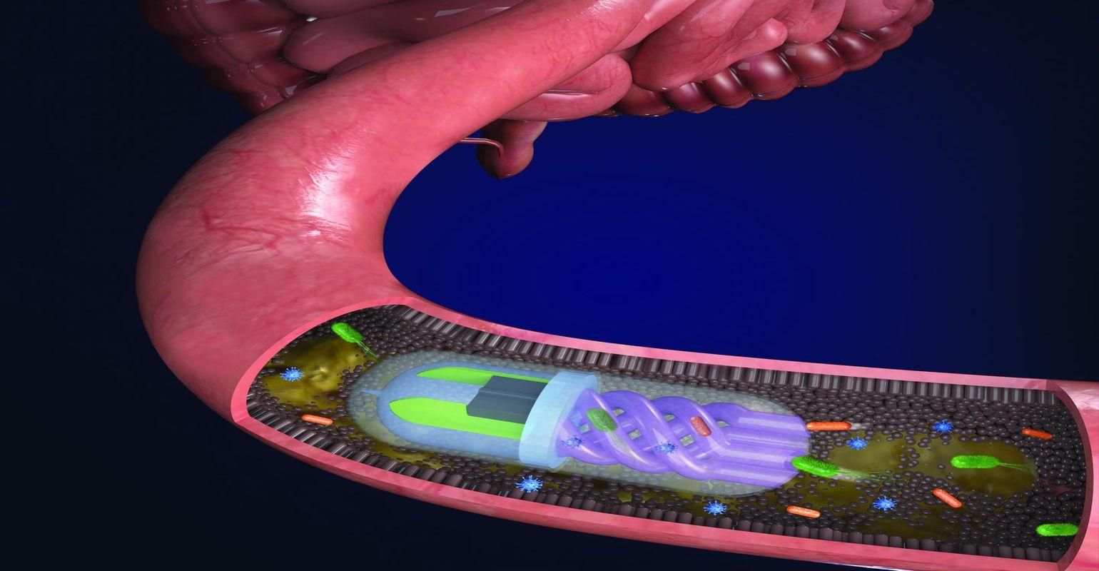 3D Printed Pill Samples Gut Microbiome to Aid Diagnosis and Treatment 3D Printed Pill Samples Gut Microbiome to Aid Diagnosis and Treatment
