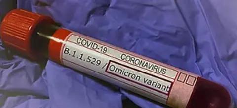 „Omicron epideminio žudiko“ idėja nepaiso ilgalaikės COVID rizikos
