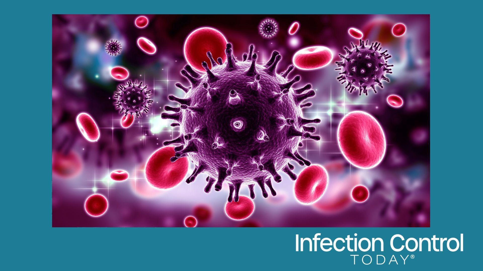 3d rendered HIV Virus in the bloodstream in color background (Adobe Stock 200344697 by RAJCREATIONZS)