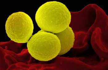 Bacterial Pneumonia   (Adobe Stock, unknown)