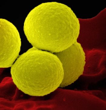 Bacterial Pneumonia (Adobe Stock, unknown)