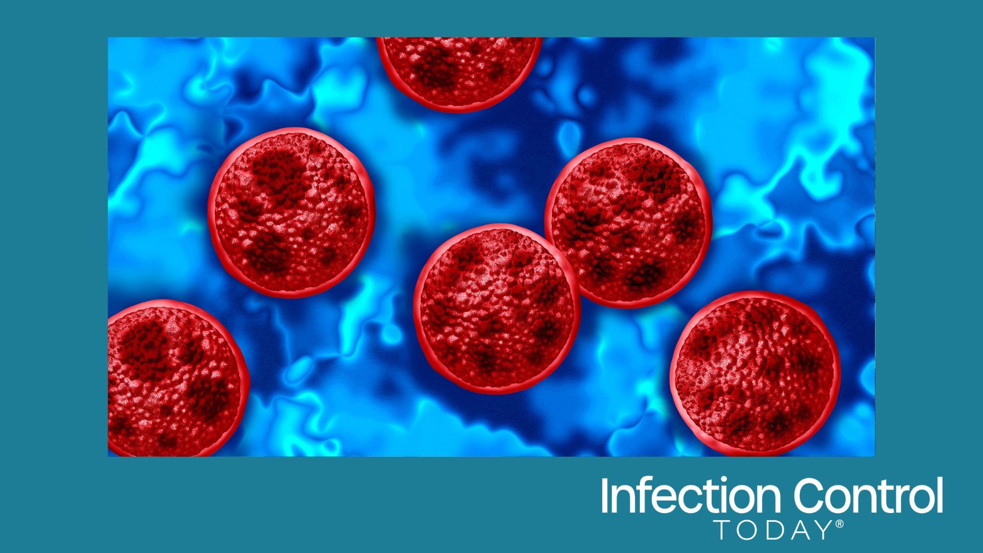 Cyclosporiasis is a foodborne parasitic illness caused by Cyclospora cayetanensis, which occurs when contaminated food or water is ingested, resulting in explosive diarrhea and other digestive symptoms. It can lead to an outbreak. (Adobe Stock 2093123932 by freshidea)
