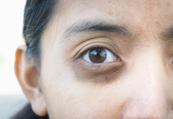 diabetes, diabetic retinopathy, telemedicine, primary care