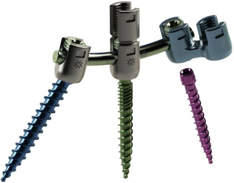 Xenix Medical receives FDA clearance for spinal fixation system: ©Xenix Medical