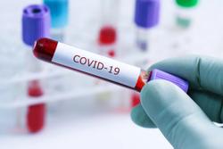 Waning immunity, not greater transmissibility, responsible for COVID-19 breakthrough infections: study