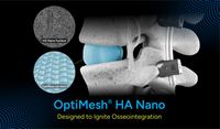Spineology launches OptiMesh HA Nano: ©Spineology