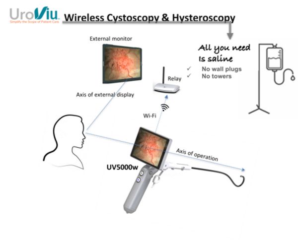 UroViu wins CE mark for endoscopy platform: ©UroViu