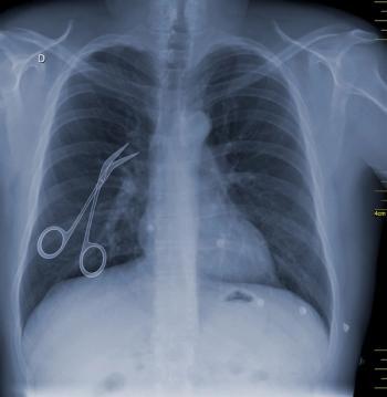 malpractice concept x-ray scissors in chest: © Jose Luis Stephens - stock.adobe.com