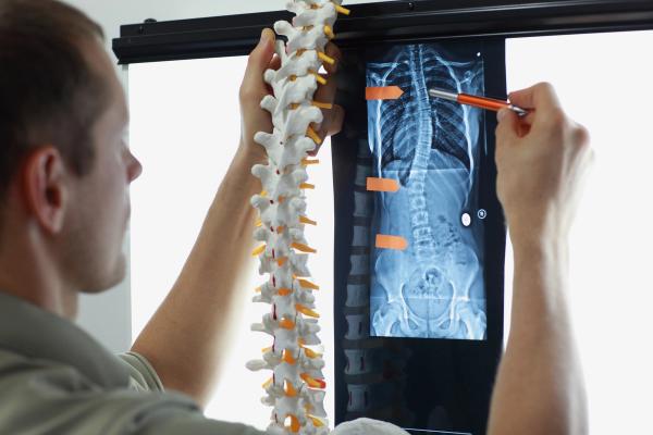 Hubly Surgical gains FDA Clearance for auto-stop drill in spine surgeries: ©Endostock - stock.adobe.com