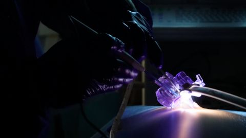 Neo Medical launches platform for minimally invasive spine surgery: ©Neo Medical