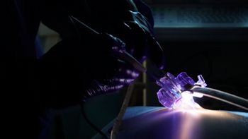 Neo Medical launches platform for minimally invasive spine surgery: ©Neo Medical