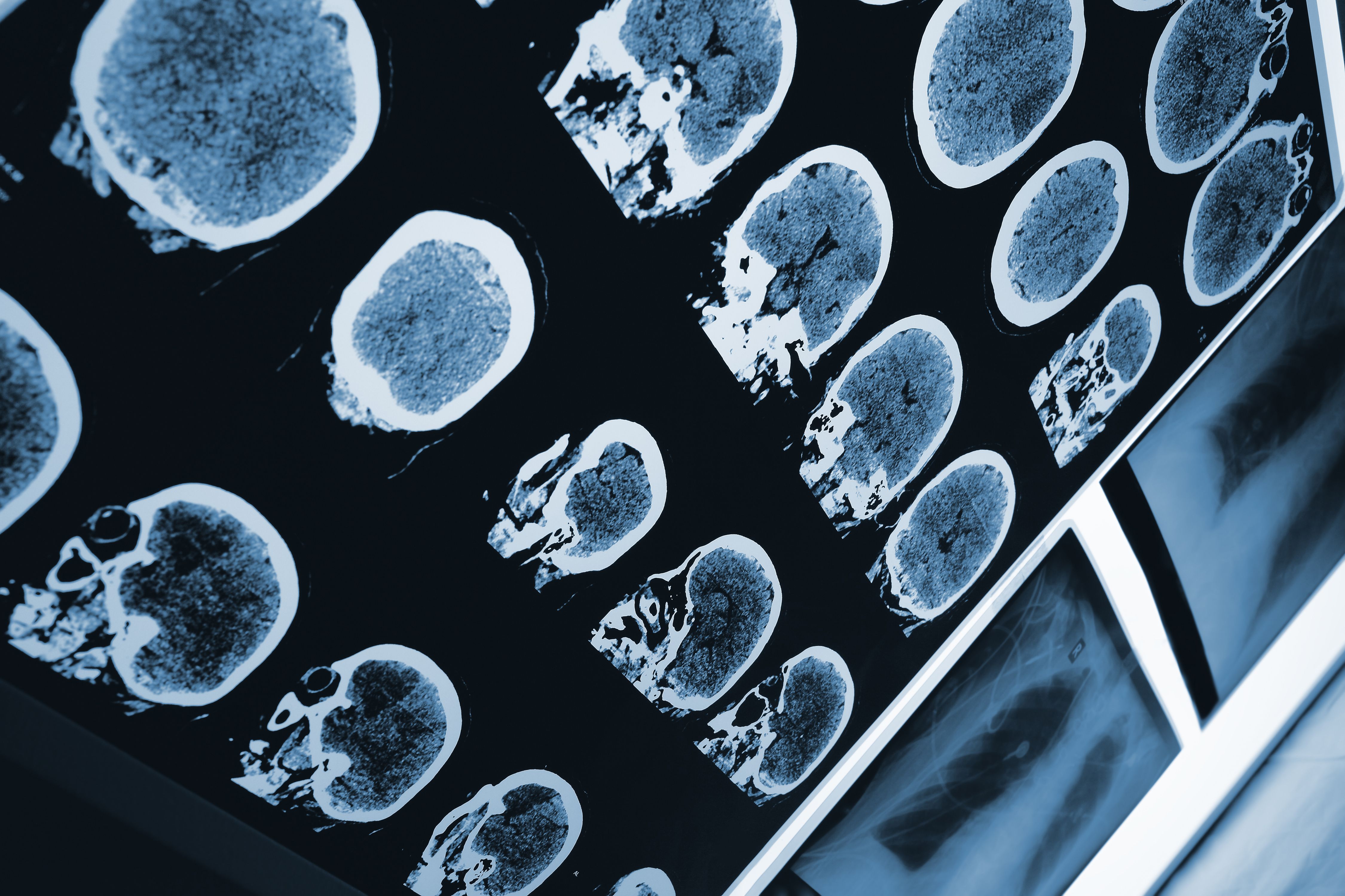 Sirona Medical product wins FDA Clearance? ©Sudok1 - stock.adobe.com