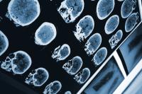 Sirona Medical product wins FDA Clearance? ©Sudok1 - stock.adobe.com