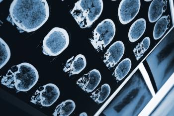 Sirona Medical product wins FDA Clearance? ©Sudok1 - stock.adobe.com