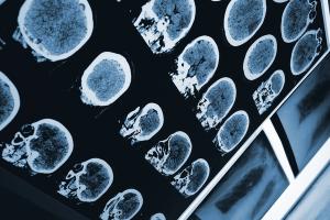 Sirona Medical product wins FDA Clearance? ©Sudok1 - stock.adobe.com