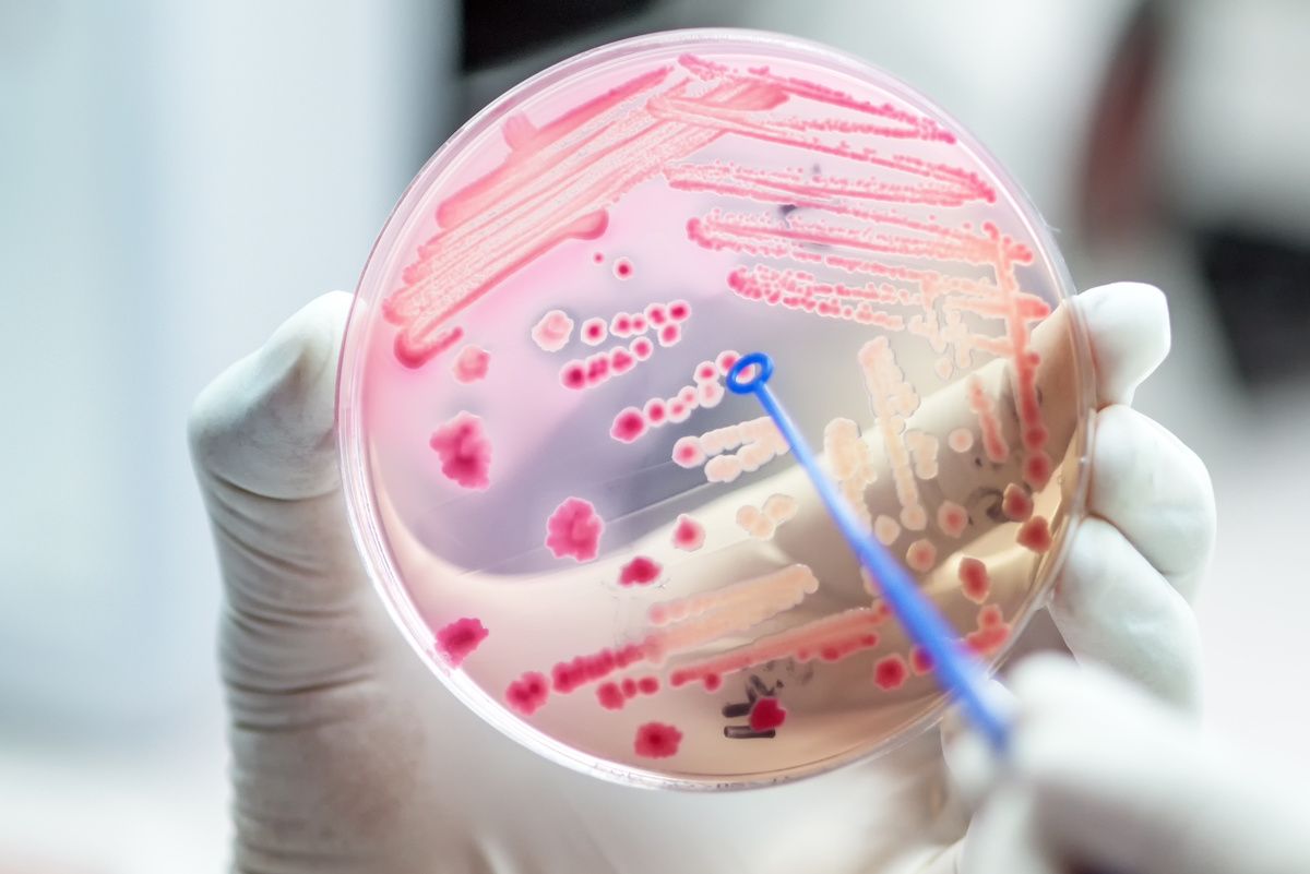 microbe bacteria colonies in petri dish amr: © analysis121980 - stock.adobe.com