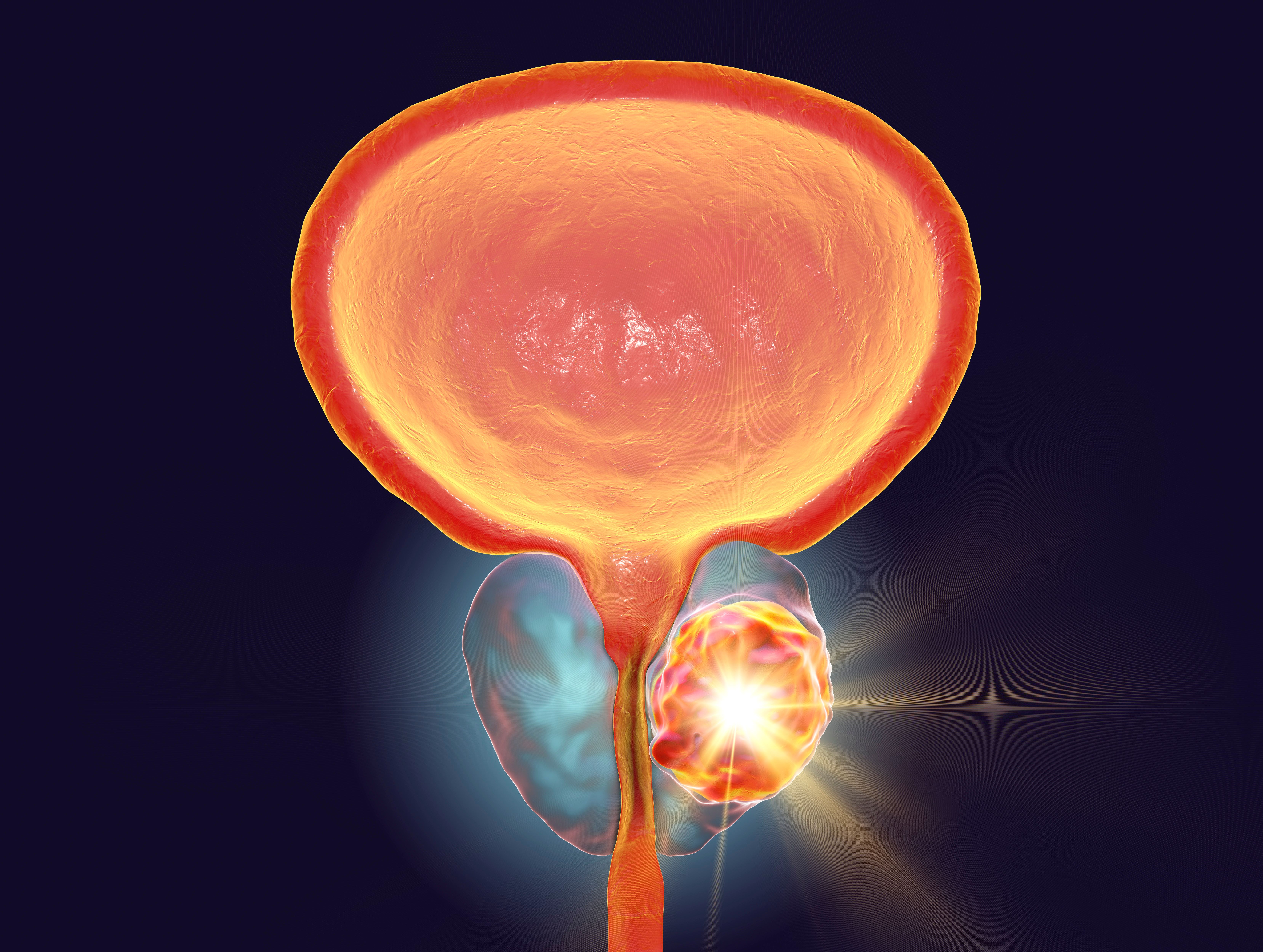 New device aims to help prostate cancer evaluation: ©Dr. Microbe - stock.adobe.com