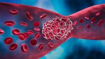 Thrombectomy device approved for large vessel stroke treatment: ©Peterschreiber - stock.adobe.com