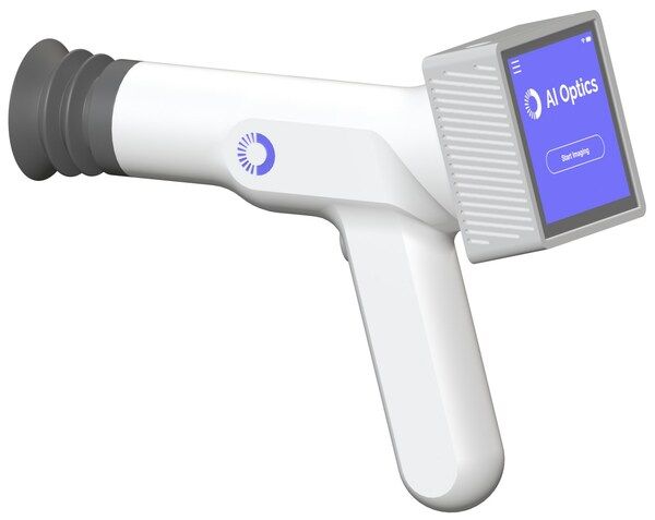 Handheld retinal scanner makes vision screening possible for primary ...