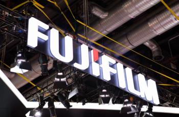 Fujifilm launches balloon-less bronchoscope: ©Eagle -stock.adobe.com