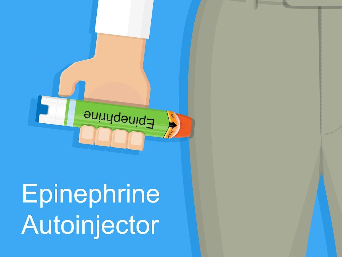 epinephrine autoinjector anaphylaxis: © Pepermpron - stock.adobe.com