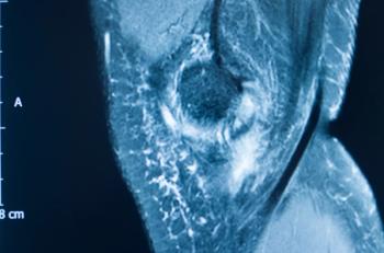 OSSIO's bio-integrative suture anchors can be used in a wide variety of procedures: ©EdwardOlive - stock.adobe.com