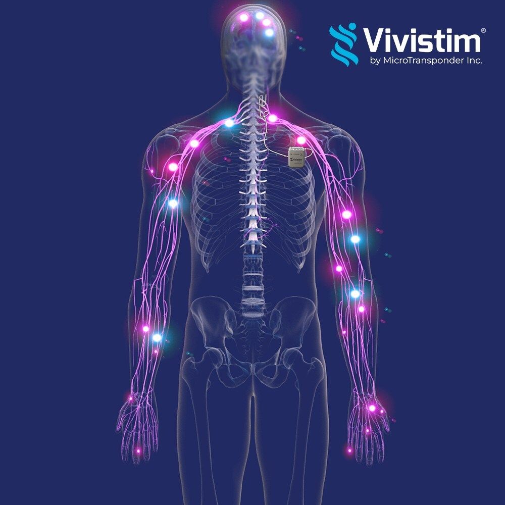 MicroTransponder secures $65 million to expand stroke recovery therapy: ©MicroTransponder
