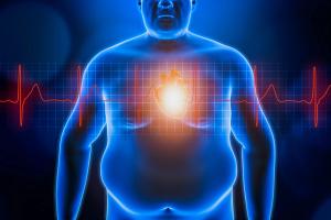 at risk population,  coronavirus, COVID-19, obesity