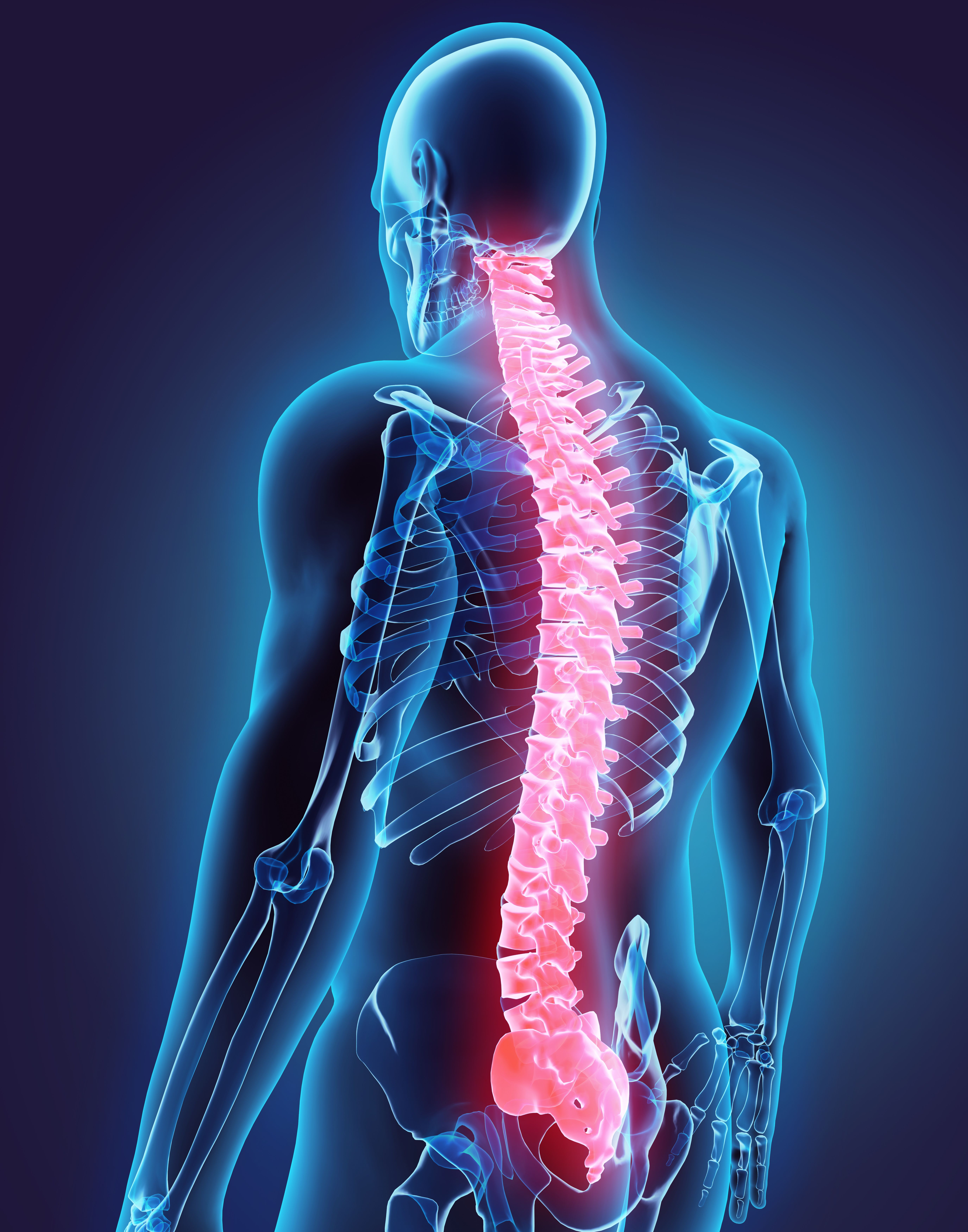 <![CDATA[Canary Medical, NanoHive partner to develop smart spinal fusion implants]]>