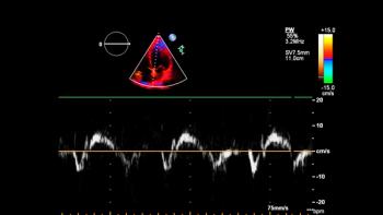 FDA approves new fetal monitor: ©Faustasyan - stock.adobe.com