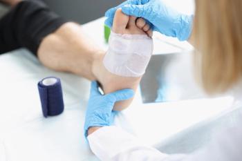 physician doctor treats foot wound © megaflopp - stock.adobe.com