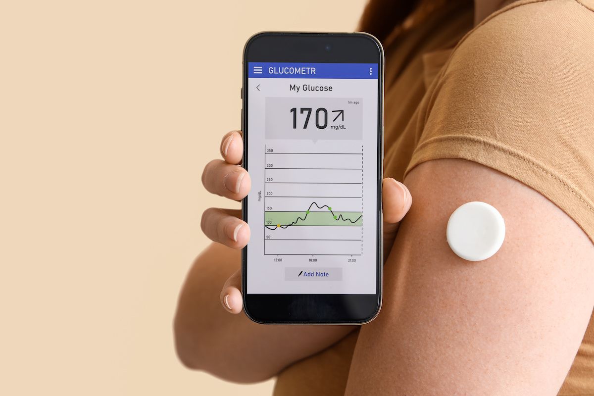 CGM can work in primary care: ©Pixel-shot - stock.adobe.com