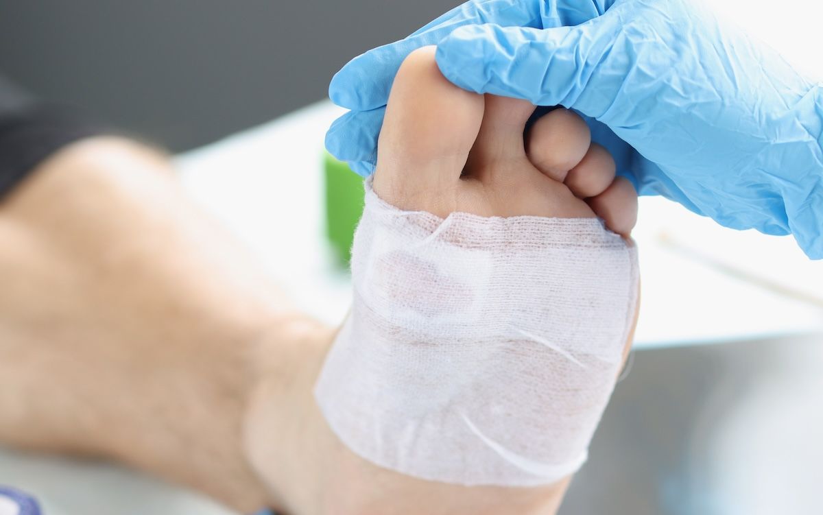 foot wound care © megaflopp - stock.adobe.com