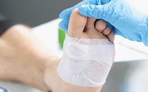 foot wound care © megaflopp - stock.adobe.com