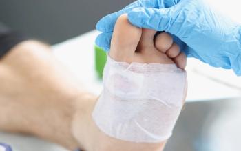 foot wound care © megaflopp - stock.adobe.com