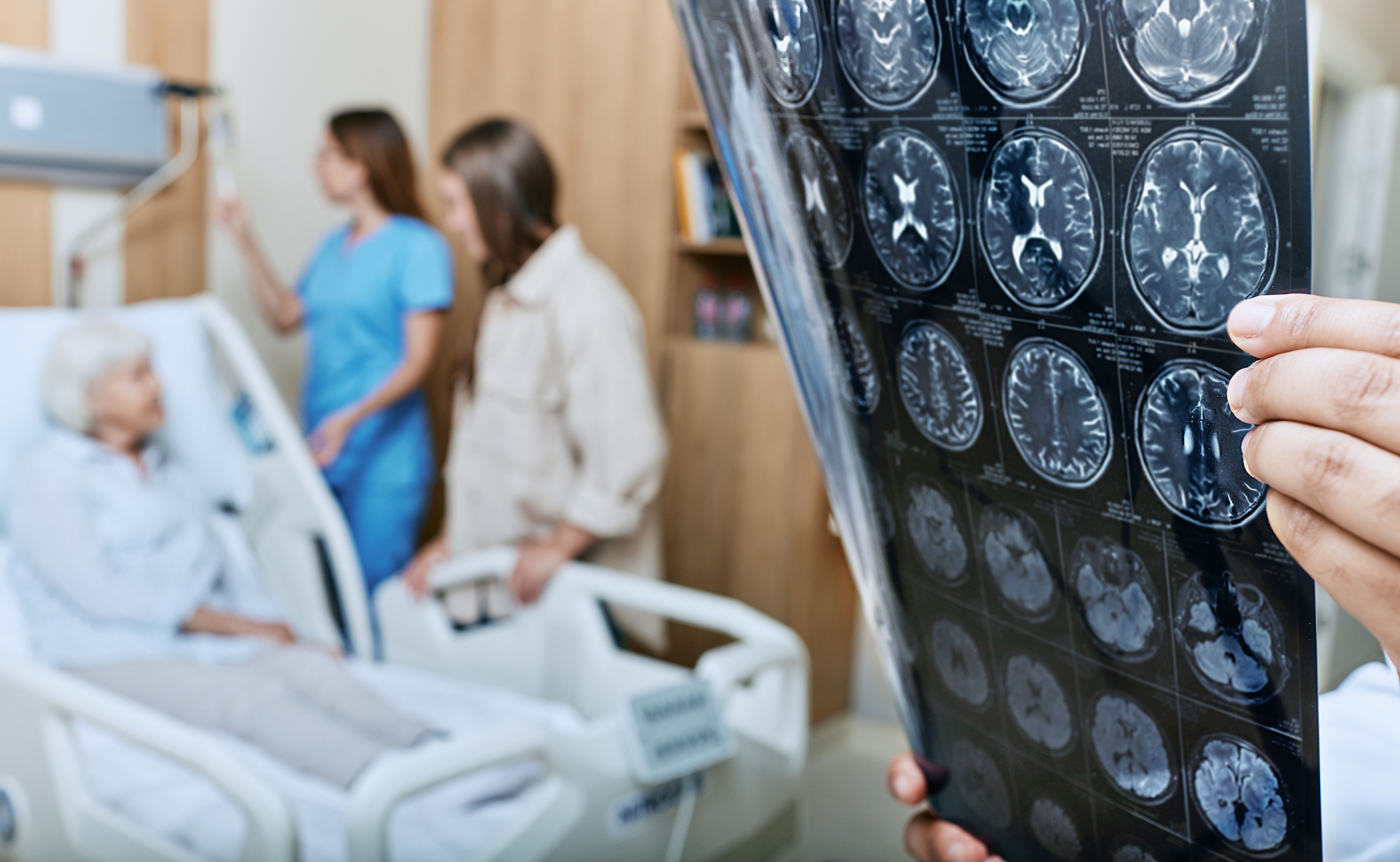 Study shows promise for portable stroke-detection tool: ©Peakstock - stock.adobe.com
