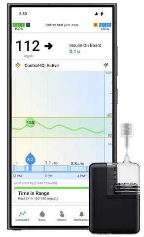 Tandem Diabetes’ Mobi Insulin Pump: ©Tandem Diabetes - stock.adobe.com