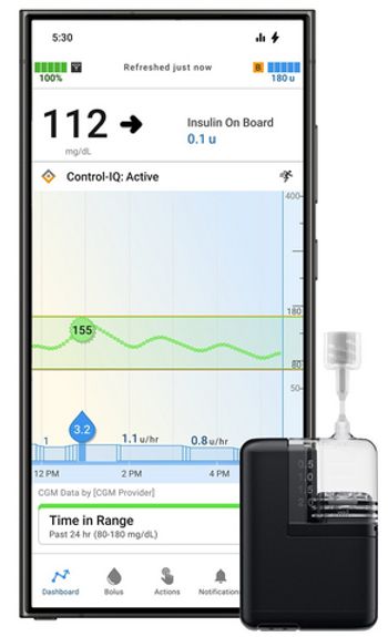 Tandem Diabetes’ Mobi Insulin Pump: ©Tandem Diabetes - stock.adobe.com