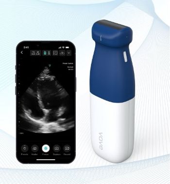 Ultrasound device aims for simplicity: ©Vave Health