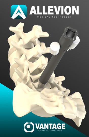 Allevion’s spinal decompression system: ©Allevion Medical
