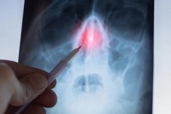 Septum nasal implant shows promise: ©Vadym