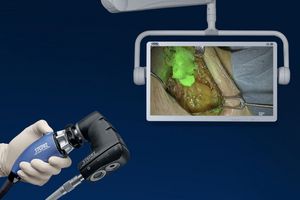 Rubina Lens receives FDA clearance: ©Karl Storz