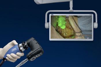 Rubina Lens receives FDA clearance: ©Karl Storz