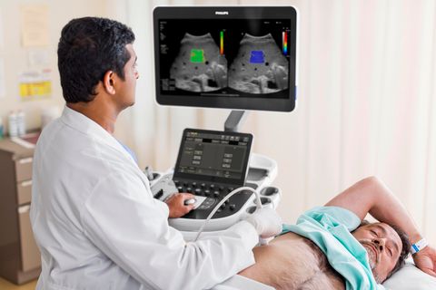 Philips invests in U.S. medtech manufacturing: ©Philips