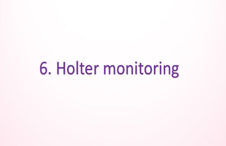 Holter monitoring