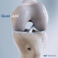 ABANZA Quadlock: ©ABANZA