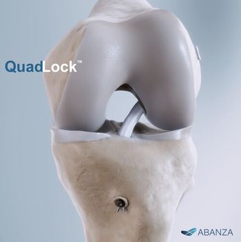 ABANZA Quadlock: ©ABANZA