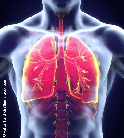 Apreo Health advances emphysema device trial: ©Aailaya Landholt - stock.adobe.com
